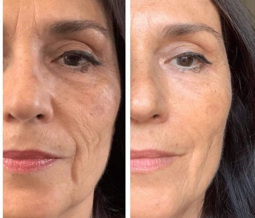 Kit Serum Manchas